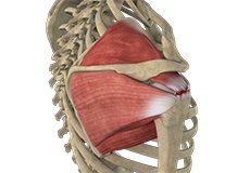 Massive Retracted Rotator Cuff Tear